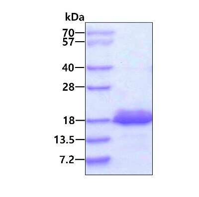 SDS-PAGE: Recombinant Human eIF4EBP2 His Protein [NBP1-51034]